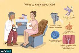 What Is Cervical Intraepithelial Neoplasia?
