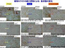 お手軽に乾燥肌を改善したい アトピーの粉ふきが気になる 面倒な事はせずにこの悩みを解決したいって人はセラ アトピー 乾燥肌 アトピー性皮膚炎
