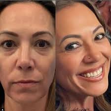 Plastic Surgery San Diego