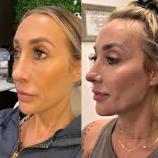 Exploring Life & Business with Robyn of Luna Skin and Aesthetics