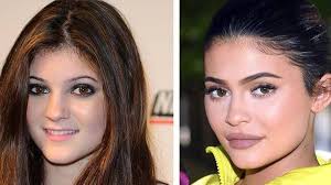 Kylie cosmetics, llc is an american cosmetics company founded by media personality kylie jenner. The Secret Behind Kylie Jenner S Shrinking Lips Nz Herald