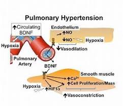 Pin On Hypertension Symptoms