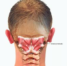 In typical cases, the pain is on one side of the head, often beginning around the eye and temple before spreading to the back of the head. Anyone Get Headaches Migraines In The Back Of Head I Tried Googling To Pinpoint Where My Pain Is Coming From Where It Is Pointing To Is The General Area I Always Get Pain