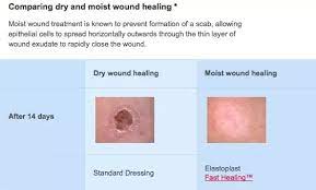 Check spelling or type a new query. Which Will Heal Faster A Cut Which Is Covered Or Uncovered Quora