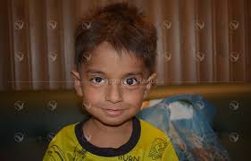 Donate Arham Ali for his Iliostomy Closure