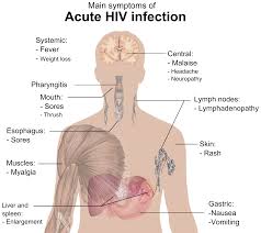 Image result for skin rash acute hiv infection