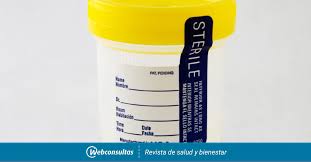 Evitar 2 días antes la ingesta de: Como Se Hace Un Analisis De Orina Pruebas Medicas