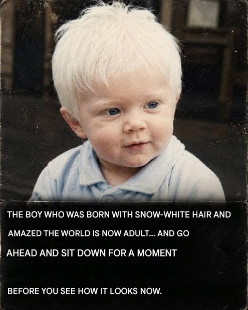 The boy born with snow-white hair &ndash; his life today