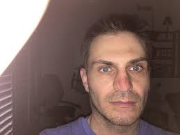 James P. Bradley, MD, Board Certified Plastic Surgeon