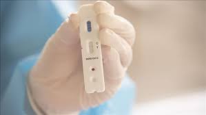 Amostras de sangue colhidas de trabalhadores para testes sorológicos na empresa liebherr, na itália. El Gobierno Argentino Presento Un Test Rapido Y Economico Para Detectar El Covid 19