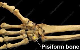 Image result for Pisiform Bone
