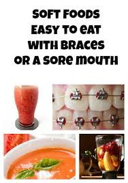 Got Braces Soft Foods That Are Easy To Eat With A Sore Mouth Braces Food Eat Soft Foods