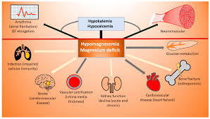 Image result for Hypermagnesemia