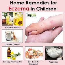 Natural Remedies For Eczema In Children Top 10 Home Remedies Natural Eczema Remedies Eczema Remedies Home Remedies For Eczema