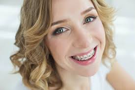 Unlike health insurance plans, dental insurance plans usually have a cap on benefits. How Orthodontic Insurance Works Orthodontist Charleston