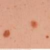 A breast cancer with a distinctive clinical presentation believed to be due to code i. Https Encrypted Tbn0 Gstatic Com Images Q Tbn And9gctnyalq213w8fun1rgxkxge93psv5vrjqlswagseqr8cjd Bs1w Usqp Cau