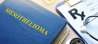Maybe you would like to learn more about one of these? Two New Cases Of Mesothelioma Diagnosed Every Day In Australia Myvmc