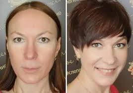 What can I do to stop thinning hair