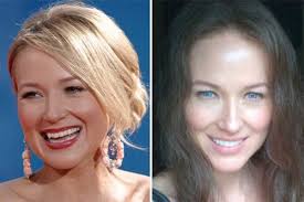 Lộ hàm răng xấu tệ của sao trước thẩm mỹ