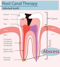 Maybe you would like to learn more about one of these? Abscess Tooth While Pregnant Causes Symptoms Preventions You Should Be Aware Of