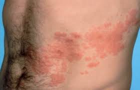 Tags for the entry how what how means in marathi, how meaning in marathi, how definition, explanation, pronunciations and examples of how in marathi. Nagin Disease Home Treatment In Marathi