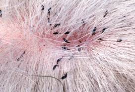 We did not find results for: Panduan Lengkap Memberantas Kutu Rambut Kerja Usaha