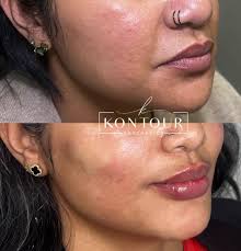 This is for the women in this group! Ladies can anyone recommend a safe ,  very reliable and experienced place for injectables ( Botox