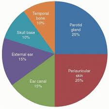 ear and temporal bone cancer oncohema key