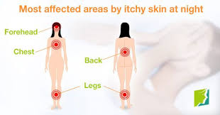 4 Areas Most Affected By Itchy Skin At Night Itchy Skin Severe Acne Remedies Skin Remedies