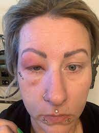 I Was Almost Blinded By A Hair In My Eye Real Fix Magazine