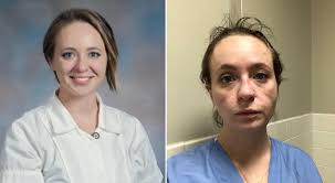 Enfermeira em hospital de tula, rússia imagem: Sic Noticias O Antes E O Depois De Uma Enfermeira As Marcas Deixadas Pela Pandemia