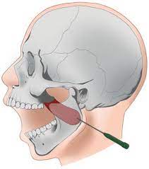 The constant velocity motion, also known as uniform rectilinear motion (u.r.m.), is the one with constant velocity, i.e., the trajectory is a straight line and the speed is constant. Orofacial Dystonia And Other Oromandibular Movement Disorders Intechopen