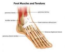 Peroneal Tendon Tendonitis Achilles Tendonitis Tendinitis Ankle Anatomy
