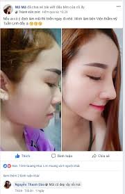Rất nhiều vụ tai nạn kinh hoàng xảy ra gần đây do tài xế điều khiển phương tiện trong tình trạng say xỉn. Nha PhÆ°Æ¡ng Nang MÅ©i á»Ÿ Ä'au Web Nang MÅ©i Khong Pháº«u Thuáº­t á»Ÿ Ä'au Ä'áº¹p