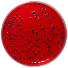 • selective and differentiating medium for the isolation of salmonellae and shigellae. Pp0320 Xld Agar E O Laboratories Ltd