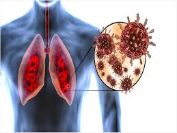 Delta plus variant in kerala: Does Delta Plus Variant Harm Lungs More Here 039 S What Experts Say Thehealthsite Com
