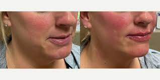 The Breazeale Clinic