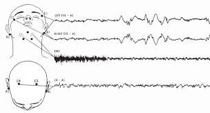 Image result for Polysomnogram