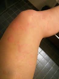 Check spelling or type a new query. Nasselutslagen Gjorde Mitt Liv Till En Pina Marias Nycklar