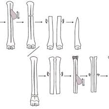 Pentru alte sensuri, vedeți os (dezambiguizare). PÄƒrÈ›ile Anatomice Ale Unui Os Lung Imagine ModificatÄƒ DupÄƒ Download Scientific Diagram