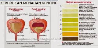 Sedangkan untuk sampel urin diperoleh warna kuning jernih. Keburukan Tahan Kencing Mamanadia Com