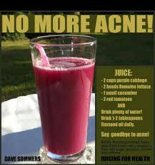How To Get Rid Of Pimples Overnight Fast Juicing For Health Acne Remedies Homemade