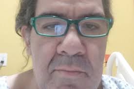 Fundraiser by Mayra May : Help Tutis with surgery & prosthetic.