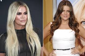 Nose surgery or job plastic surgeons typically use simulation software in their facilities to render the kind of look that the despite all the controversy surrounding the app, isurgeon is another greatly rated simulator. Khloe Kardashian Says She S Only Gotten One Nose Job