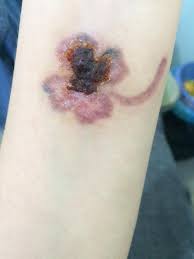 Nếu bạn khó khăn trong việc cương cứng, hãy tích cực bổ sung những loại quả này vì nó được nghiên cứu là có tác dụng còn hơn cả thần dược phòng. Xoa Hinh XÄƒm Ä'á»ƒ Quen Tinh CÅ© Sau Khi Bá»‹ Pháº£n Bá»™i Co Gai Bá»‹ Nhiá»…m Trung Hoáº¡i Tá»­ Da Ä'au Ä'á»›n