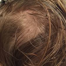 Honey blonde hair is a blend of dark and warm blonde with light brown. Winning The War Against Headlice Dear Mummy Blog