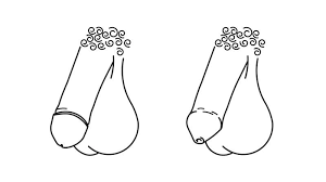 What does it mean to get your balls dropped? Are My Penis Testicles Normal Facts About Male Anatomy