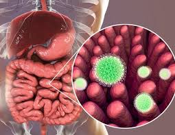 Rotavirus commonly causes severe, watery diarrhea the most common symptoms of rotavirus are severe watery diarrhea, vomiting, fever, and/or abdominal pain. Rotavirus Symptoms