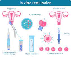 Fasi Di Ivf