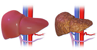 Hepatitis B Die Krankheit Und Der Impfstoff
